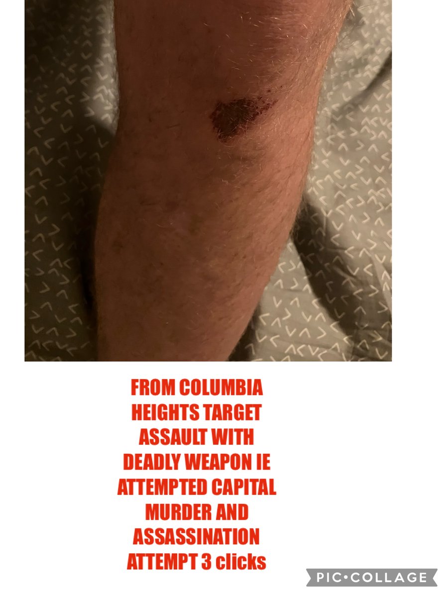 gregsnelson's tweet image. I AM NOW ;-) such a hoT mess. Well thaT depends Rina, he said he knew Jazelle. The BLACK DC POLICE &amp;amp; DARBY  came in again w/o a warrant and made me eat my shit. @Target @BravoTV @HillaryClinton @HodaAndJenna @tomsietsema @nbcwashington @NorahODonnell @LesterHoltNBC