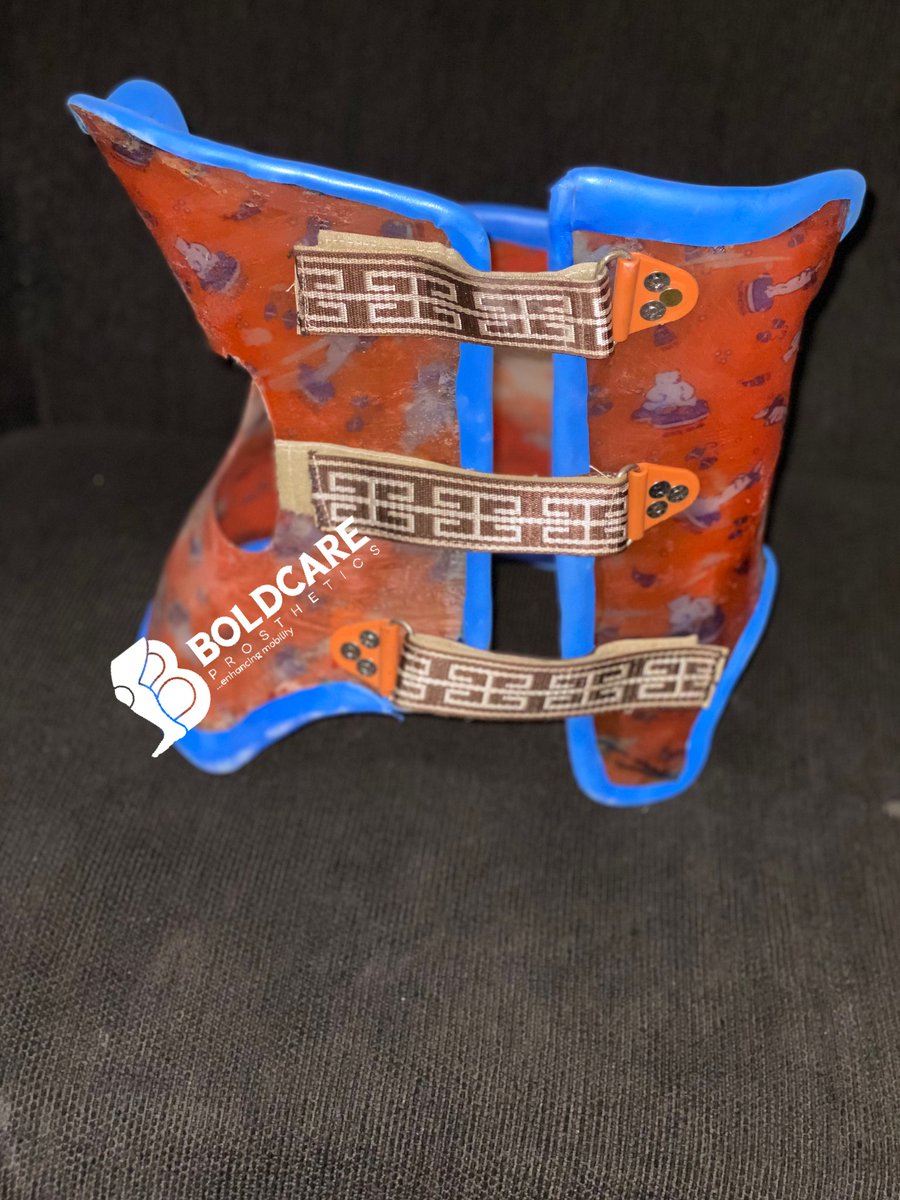 Boldcarepro's tweet photo. BOSTON BRACE: This is typically used in Correcting and Preventing the Curvature of the Spine in Patients with SCOLIOSIS.
#orthoticfittings
#scoliosis
#orthotics
#spinalorthosis
#thoracolumbarcurve
#myprofession
#mypride
Contact us For PROSTHETIC/ORTHOTIC SERVICES. https://t.co/BSEaQGNv64