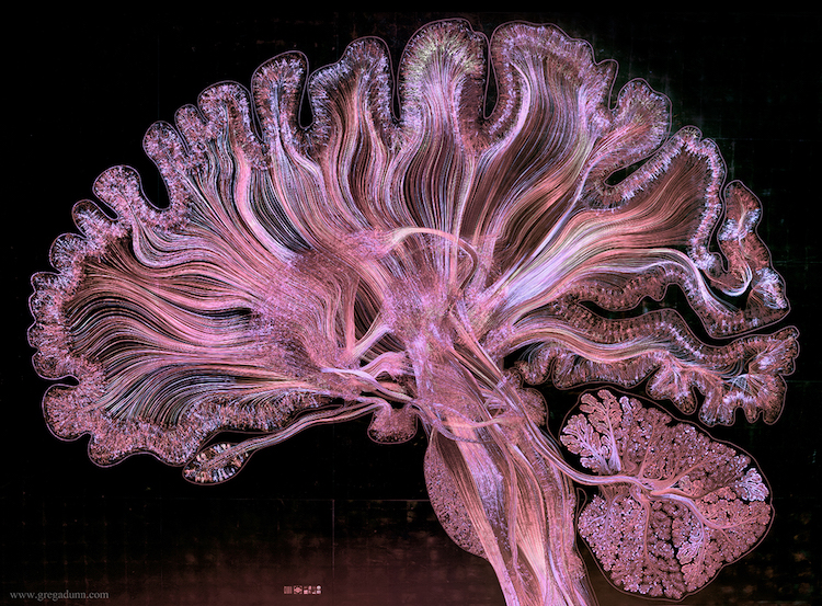 Brain and its internal wiring:

#neuroscience by G. Dunn