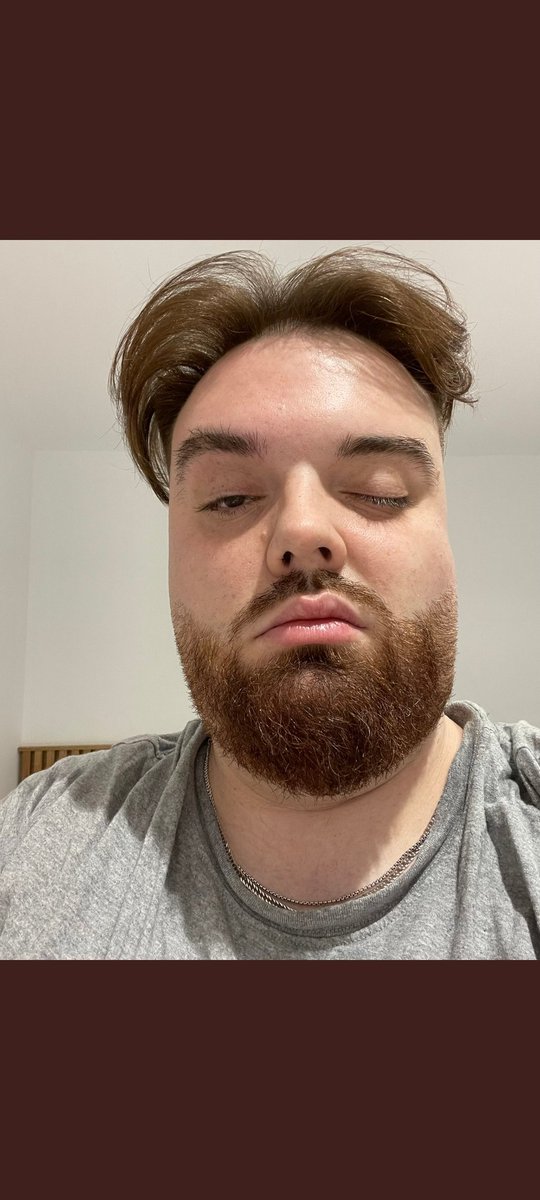 𝑰𝒓𝒓𝒂 tweet media