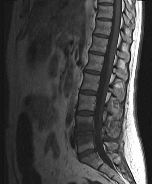 Basic Neurosurgery on Twitter: 