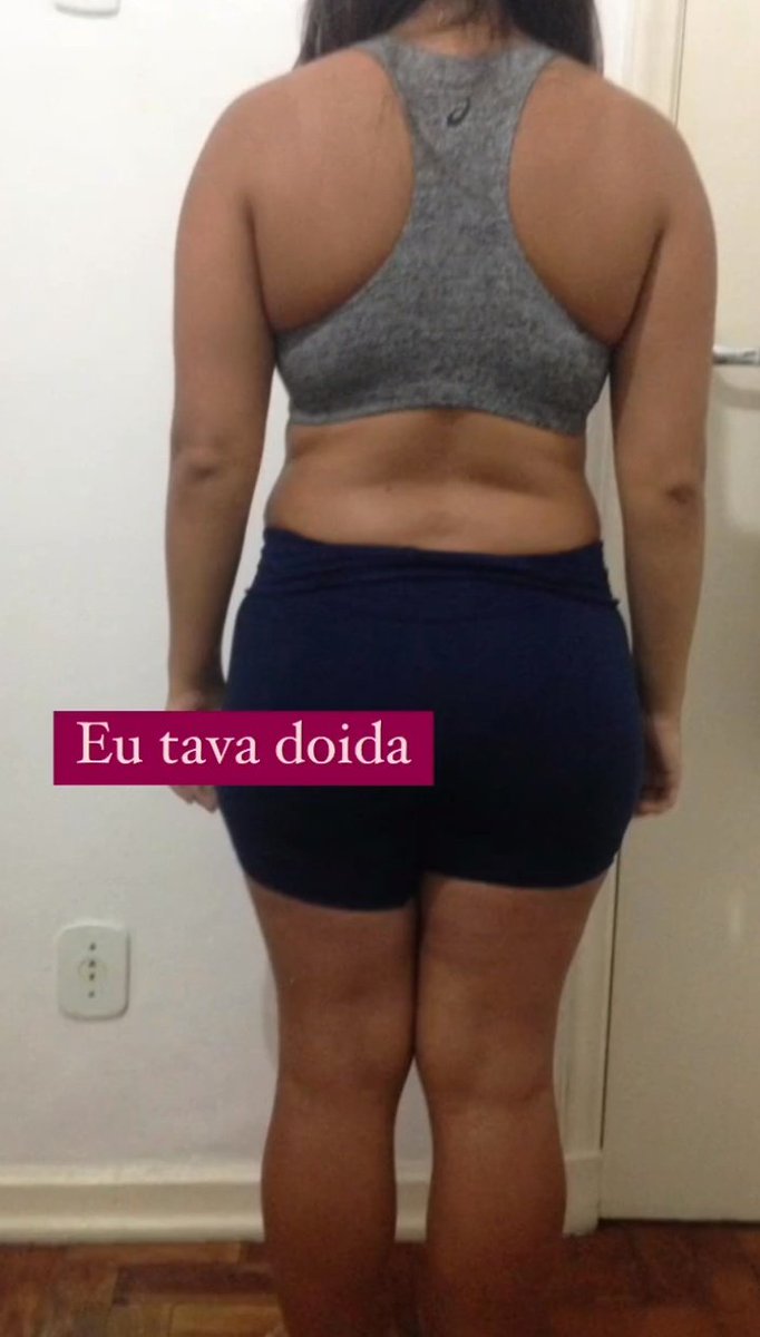 toxicckc4l's tweet photo. Gente, se eu fosse "magra" assim eu me matava, qual é a definição de magreza pra ela? Usar 40? https://t.co/EHO3IWeZp3