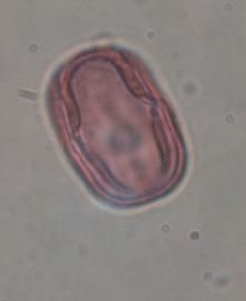 MescalProject's tweet photo. #Dec16 Each #PollenGrain shows different #Apertures, structures which help the genetic material to leave the grain. When these apertures have a circular shape we call them pores, if they are elongated, colpi, and they can even combine both in colpori! #AdventPolendar https://t.co/p2aGKNavhc