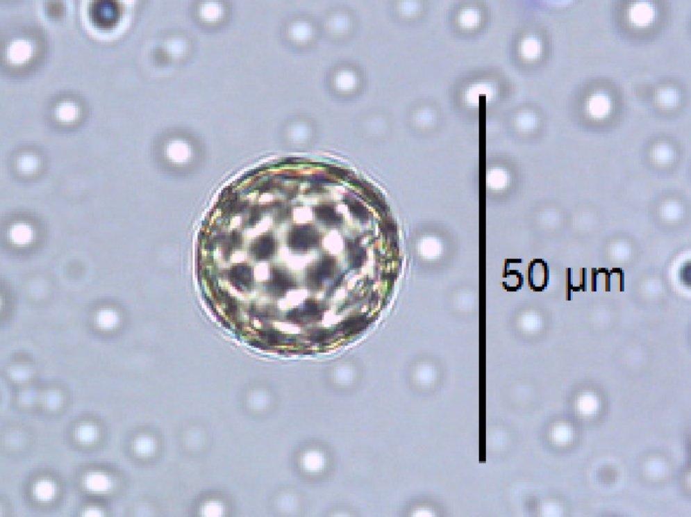 MescalProject's tweet photo. #Dec16 Each #PollenGrain shows different #Apertures, structures which help the genetic material to leave the grain. When these apertures have a circular shape we call them pores, if they are elongated, colpi, and they can even combine both in colpori! #AdventPolendar https://t.co/p2aGKNavhc