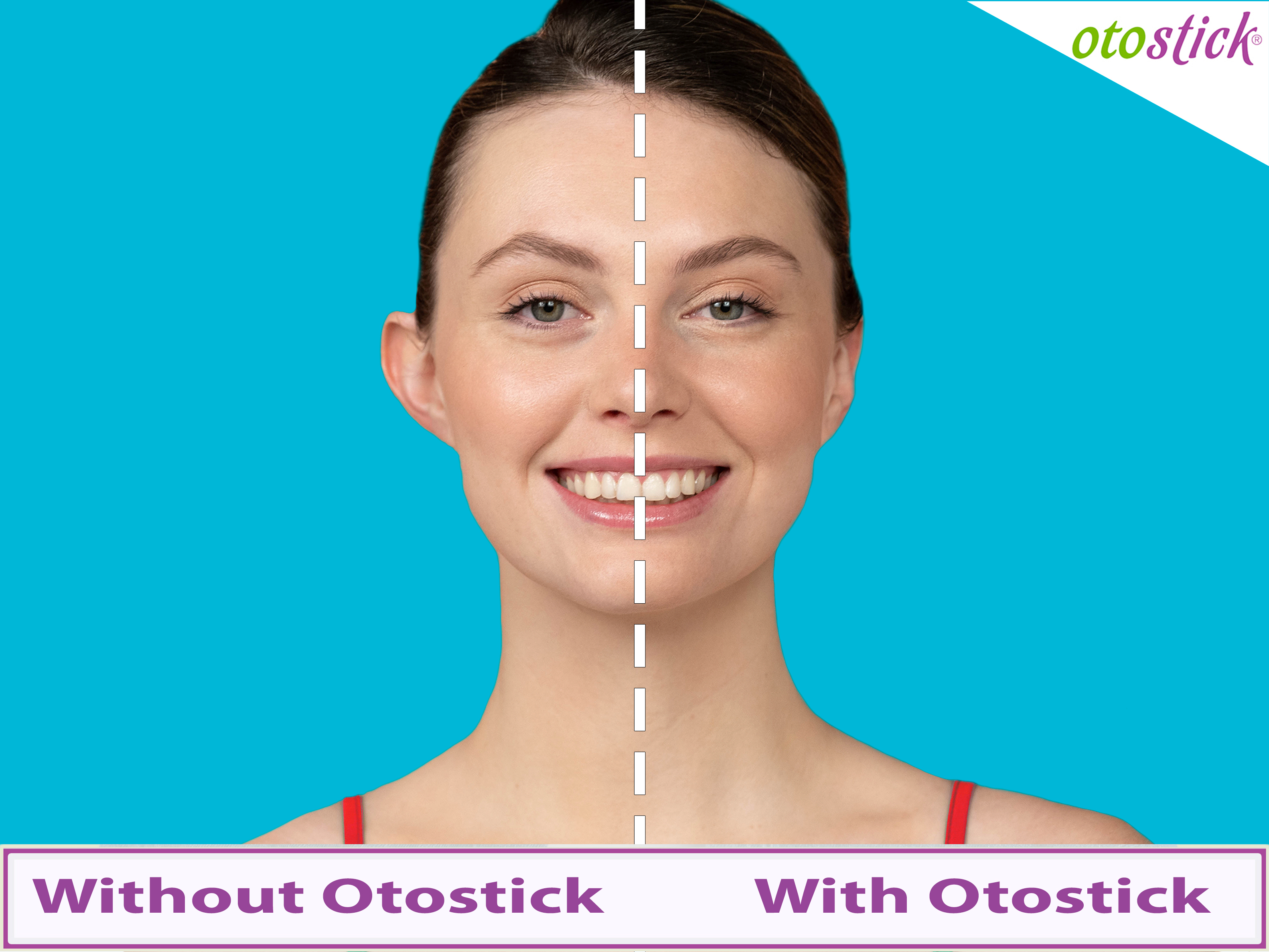 Otostick UK on X: Otostick ear correctors are easy to use and very  discreet. Buy now at   / X