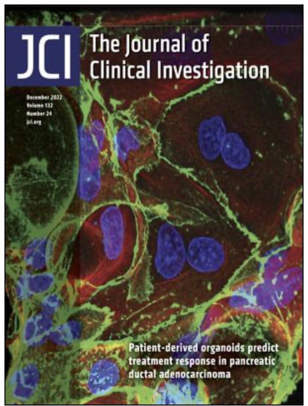 #PancreaticCancer organoid based platform from @MDAndersonNews on the cover of @jclinicalinvest jci.org/articles/view/…