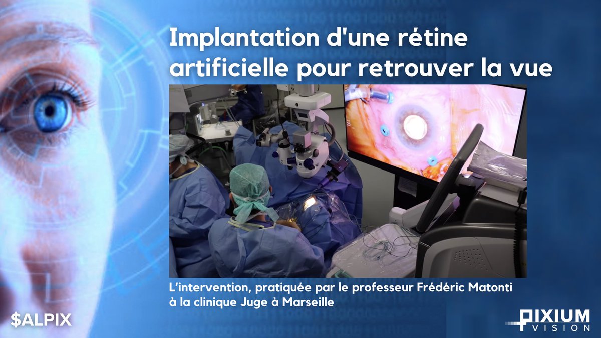 PixiumVision's tweet photo. DMLA sèche : de réelles promesses avec le nouvel implant rétinien
N’hésitez pas à voir ou à revoir l’interview du Pr Frédéric Matonti : https://t.co/9d7ucSZm7M
Lire dans @laprovence : https://t.co/SPLUAUDOL7
#pixium #vision #prima #marseille #DMLA #DMLAseche #implant #retine https://t.co/1PGVeD0zaz