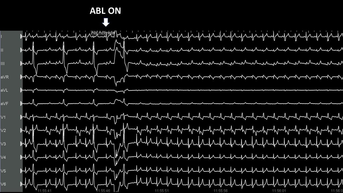 Luis Quininir, MD ECES FACC 🇨🇱 tweet media