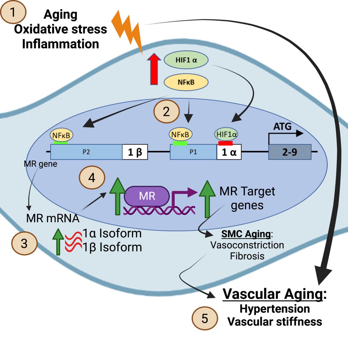 After 25 years, news re: mineralocorticoid receptor (MR) regulation. NFkB and HIF1a regulate MR in aging human vascular smooth muscle. Rising MR drives vascular aging even if the ligand aldosterone is not hi... @TuftsMCResearch @IrisJaffeLab @Jai_Ibarrola ahajrnls.org/3WgzzqA