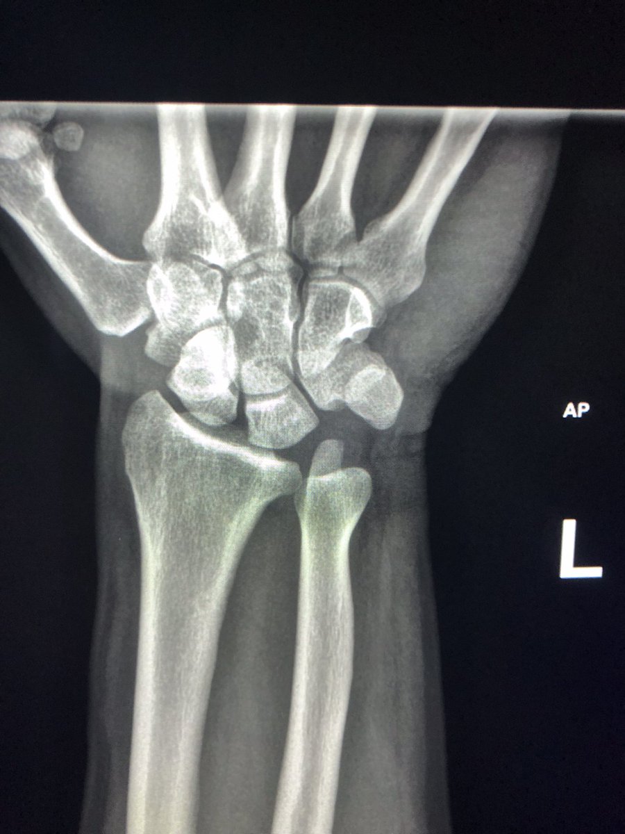 bacole26's tweet photo. Rare injury. https://t.co/4sK44Q27X3