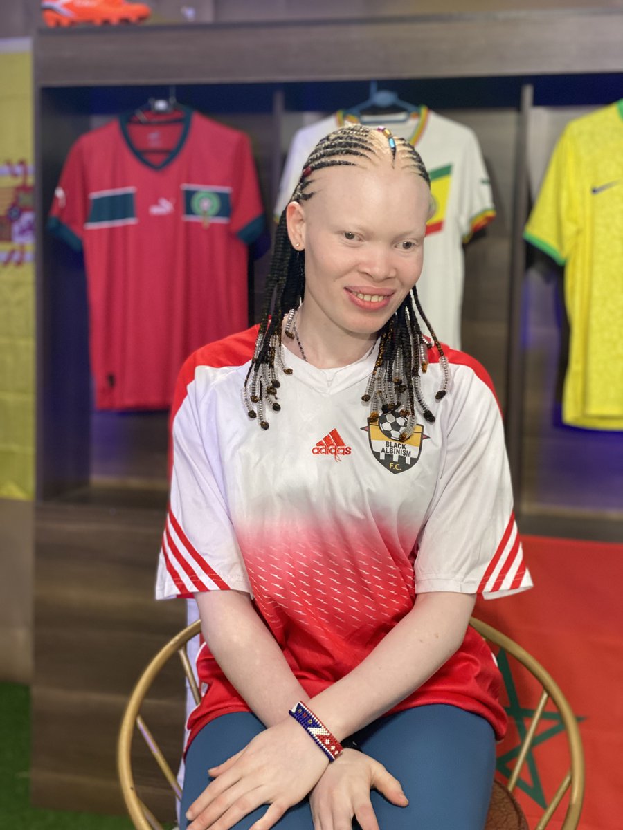 Enhancing and celebrating our differences makes the world a more beautiful place. 
Absolute awesomeness. #albinism #albinismisbeautiful.