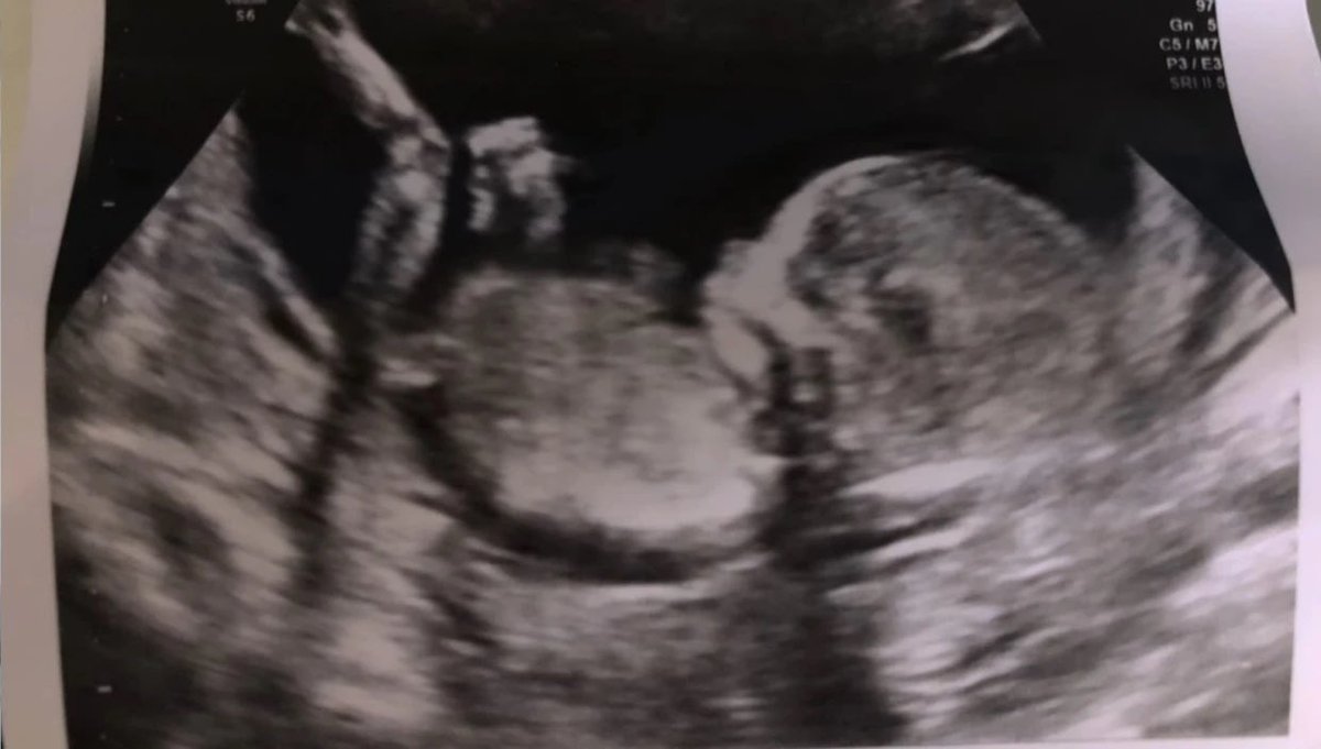 hrrysgreysuit's tweet photo. M &amp; H share Archie's SCAN picture in Netflix series &amp; tons of preg pics

M really really wanted us to know she was pregnant 🤣 and for 100 million dollars they threw in the ultrasound pic 😂 but 🤫they want their privacy so don’t show this to anyone🤫

 https://t.co/Y9J9PDMZbs https://t.co/omCmmglDg4
