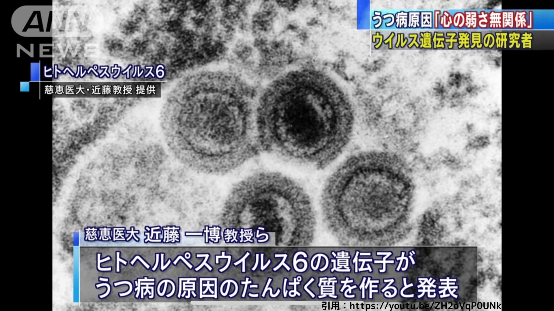 これは驚き！「うつ病と心の弱さは無関係」が判明‼