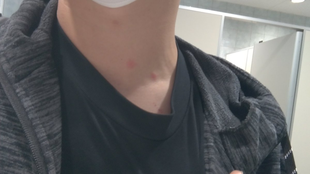 首の被弾率高スギィ…
ちょうど寒くなるしネックウォーマーでも付けようかしら