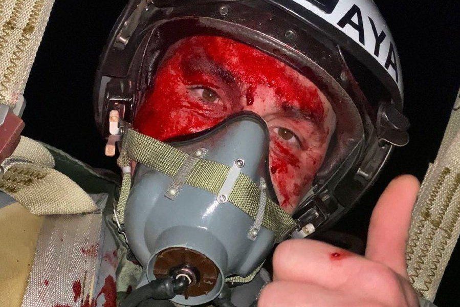Forbes's tweet image. His MiG-29 In Flames, Blood Pouring Down His Face, This Ukrainian Pilot Still Managed To Snap A Selfie trib.al/EgXthZO