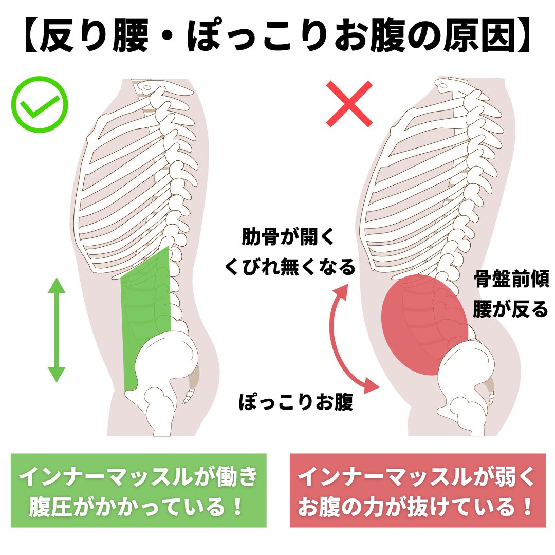 ogitoreshota's tweet photo. 反り腰の方でよく腹筋を鍛えた方が良いと言うけど腹筋よりまずはお腹の奥にある『インナーマッスル』を鍛えた方がいい！これを鍛えることでお腹が安定して「腰の反り」や「ぽっこりお腹」、「肋骨の開き」全てが解消しやすくなる！インナーを鍛える方法を載せていきます！ https://t.co/47VSz998Vv