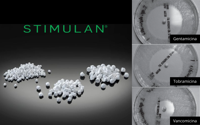 Biotechsa's tweet photo. El sulfato de calcio (100% puro) es altamente biocompatible, totalmente absorbible y se usa cada vez más para administrar antimicrobianos en los huesos y tejidos blandos. - https://t.co/aGw0q5hiDX #biotechsa #stimulan #antimicrobianos https://t.co/uySPJXL5qi