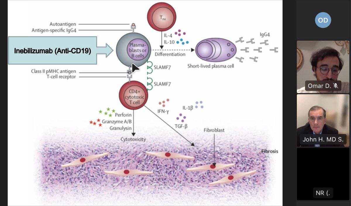 Rupee_Indipexy's tweet photo. [4/4] Treatment:

-💊 Steroids ➡️ current standard : taper to 5mg at 2mths &amp; off at 3mths but with ⬆️ flare rate
-💉RTX ➡️ targetting B-Cells 🔑 in disease management 
-Current multicentric RCT on promising Inebilizumab (anti-CD19) results 📑 2023 🗓 https://t.co/MXdeNispjM