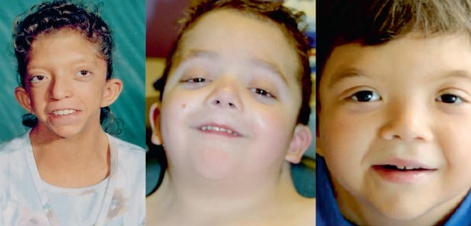 What is the pediatric syndrome? https://t.co/UdQBeyEARY