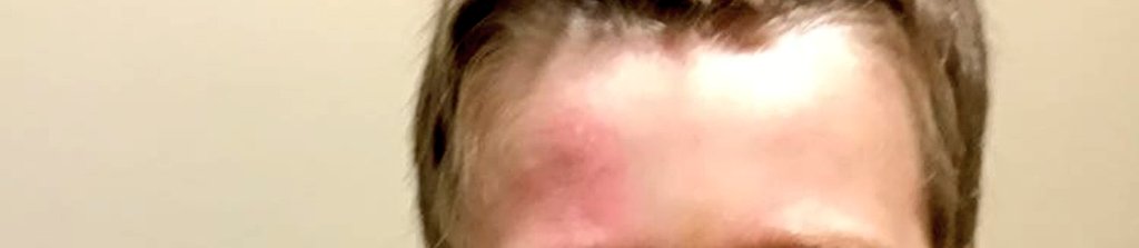 RemoveTheRoom's tweet photo. @FidgetyF_cker It can be as physically damaging. And unfortunately that use of force for "behaviour correction" is still legal 🫠🥺 #RemoveTheRoom #UnreasonableForce https://t.co/PUiFFgw7fL