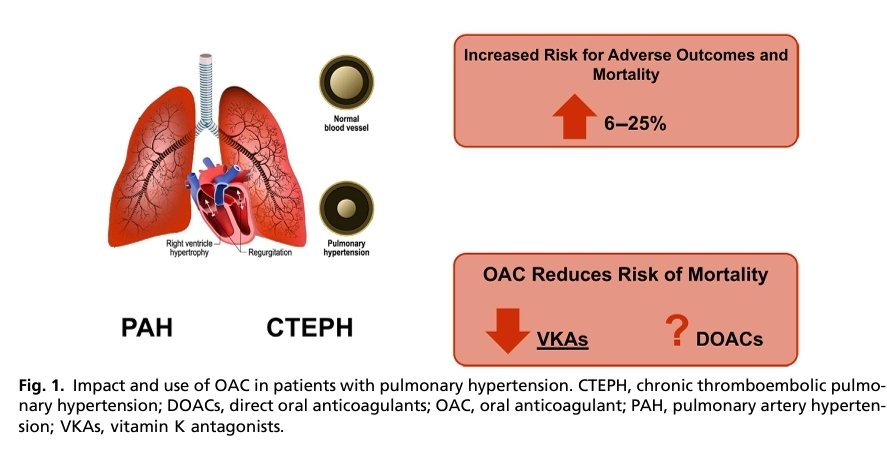 KessnerJp's tweet photo. Anticoagulation in Pulmonary Hypertension: evidence?
https://t.co/akt2oIuEkN
🫁❤️‍🩹💘💊📚⁉️
@HeartFailureFrm @atscommunity @accpchest @SeparRespira @socapnet @SPLF_SocPneumo @ALATorax @SeparCPulmonar @PH_PSP @EuroRespSoc @NeumoMadrid https://t.co/xsQaPriqHQ