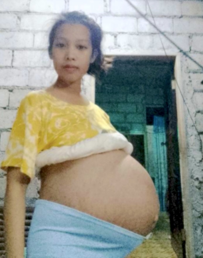 KM_Jessica_Soho's tweet photo. Matapos manganak ng kambal, tiyan ng isang babae sa Quezon Province, lalo pang lumaki?! May laman pa kayang sanggol ang kanyang tiyan? #KMJS https://t.co/RgLp1dLXkG