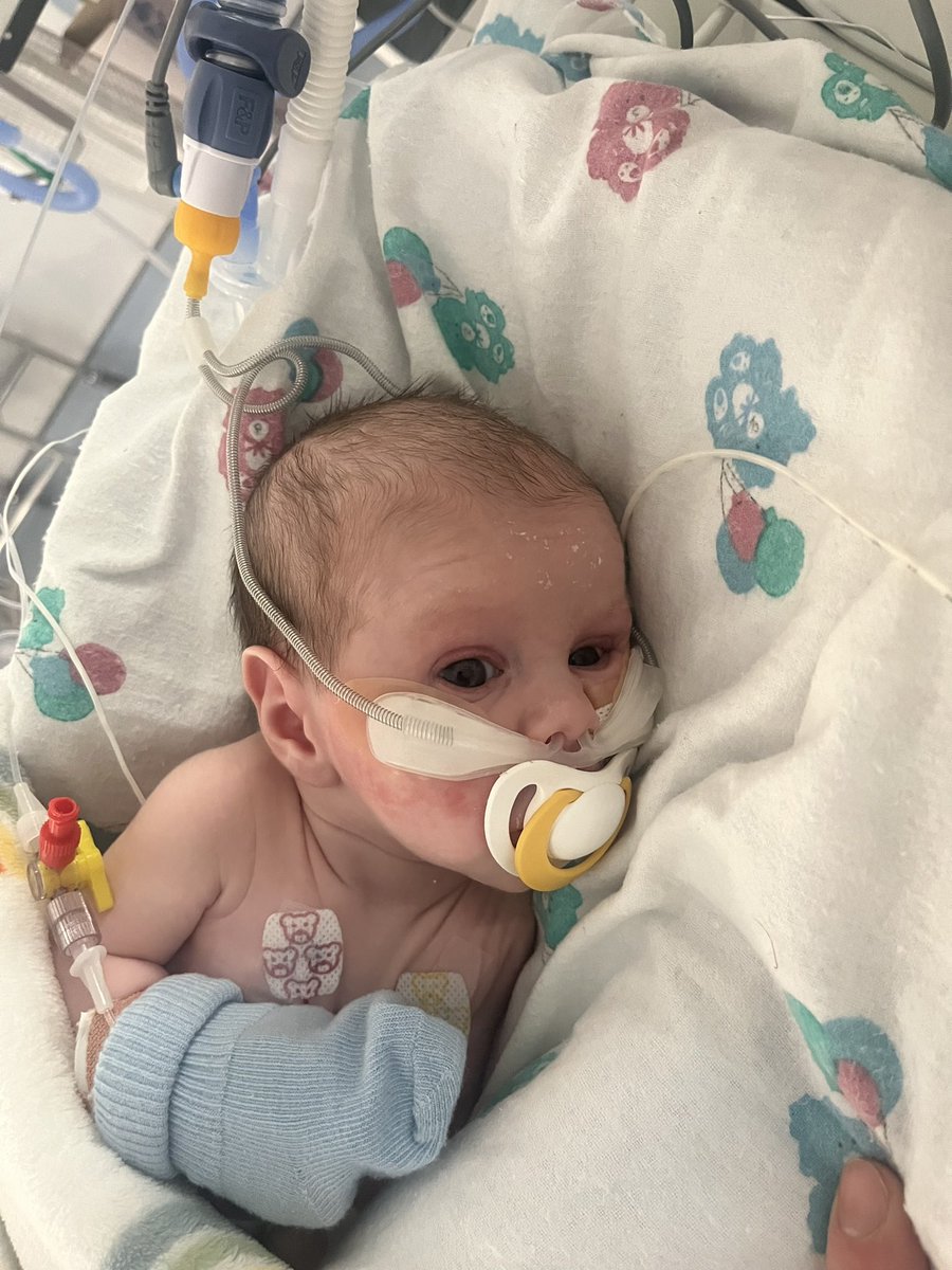 Nearing 2 weeks in ICU, 9 days on a ventilator machine breathing for him, this morning James felt he had enough of the machine and the tube and decided it was time it came out! 

Massive step forward 💪🏻

So proud of this little champion, he’s a warrior, absolute warrior ❤️
