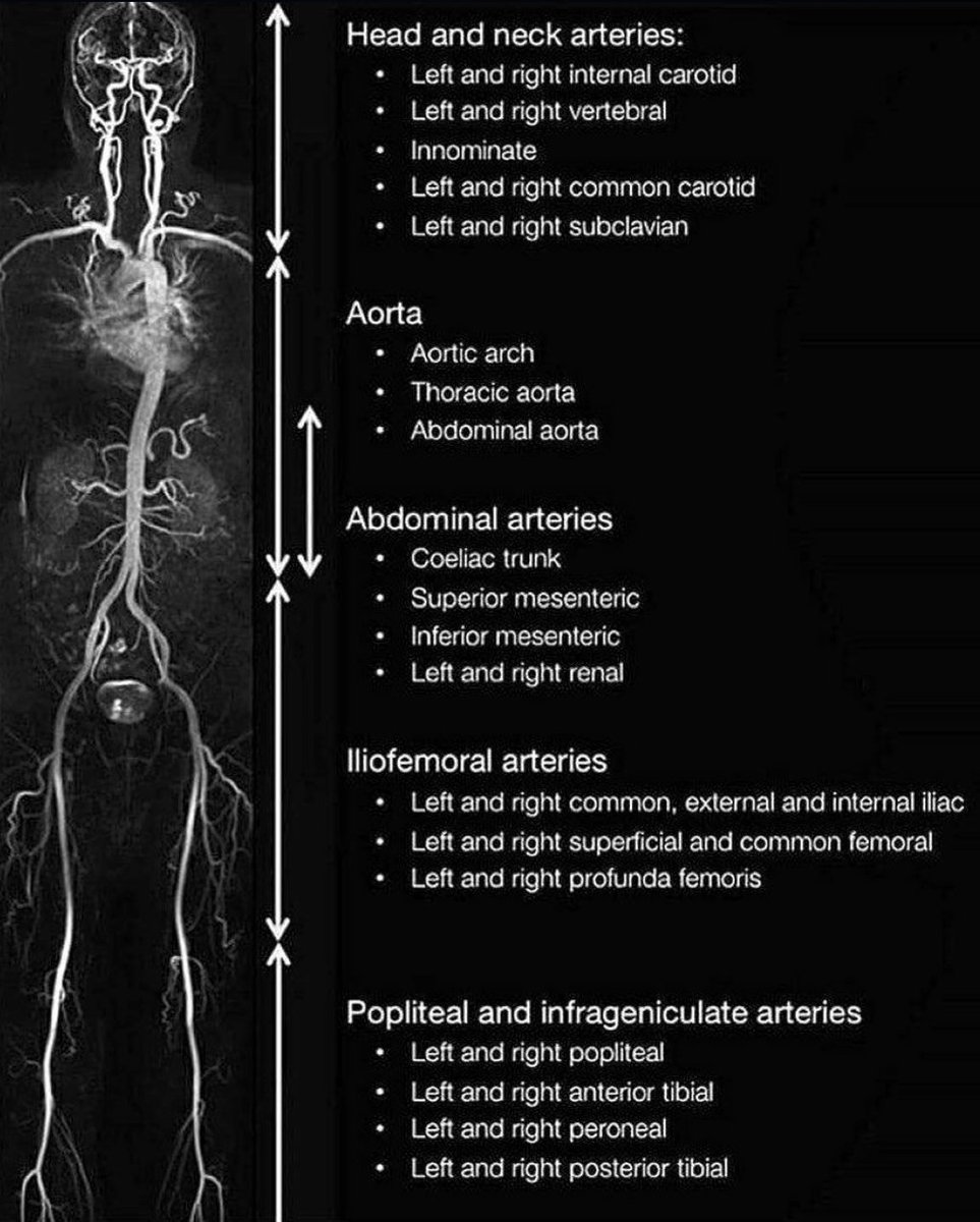 Innov_Medicine's tweet photo. Magnetic resonance angiography (MRA) of arteries of the body
#meded #medtwitter https://t.co/eIayqJSNic