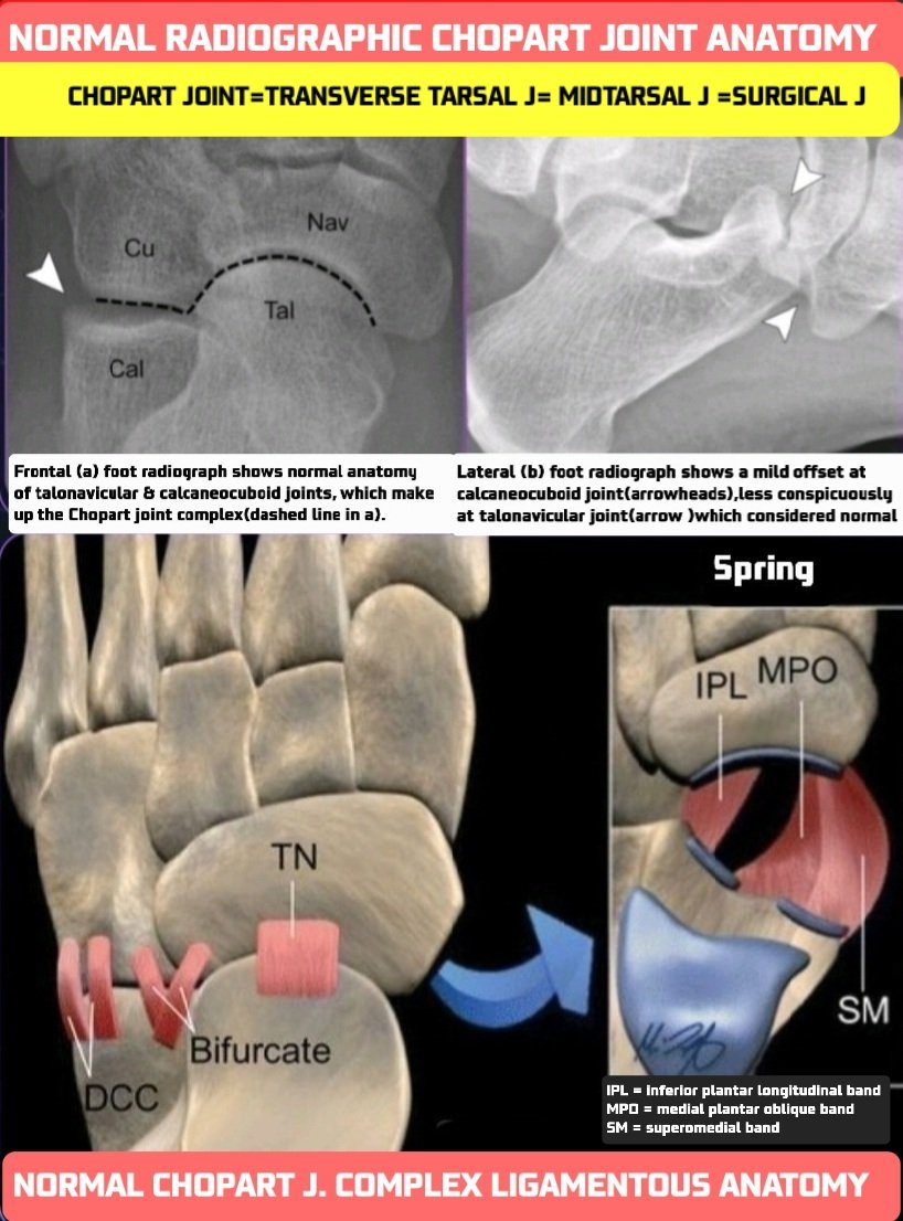 Imaging of Chopart (Midtarsal) Joint Complex: Normal Anatomy and