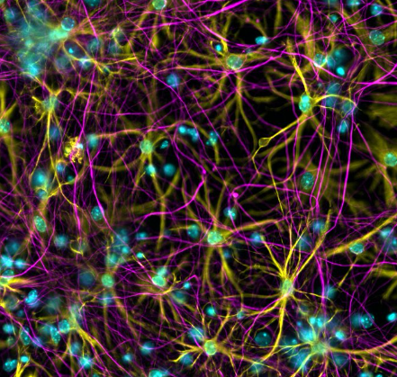 Our latest #ARUKImageoftheWeek is a colourful variety of brain cells!

@ColinPhD works in the McColl lab @EdNiBL @UKDRI to study the different cells in our central nervous system (CNS) and how they are affected by the brain’s immune cells in conditions like stroke and dementia.