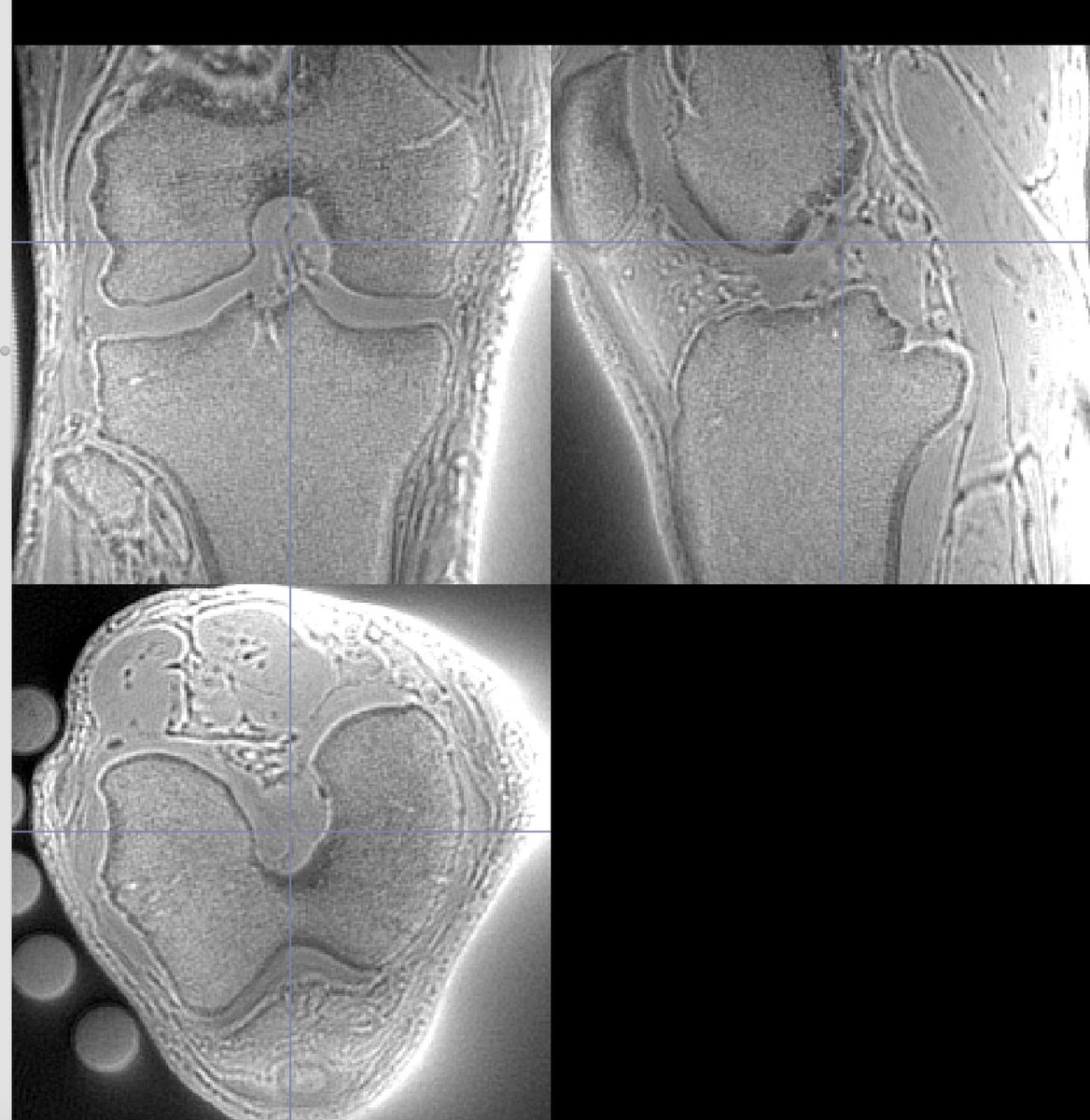 Here is the first echo one (20 us) <a href="/DrFangLiu/">Fang Liu</a> . I will post more updates on the following page. 

github.com/uzayemir/23NA-…