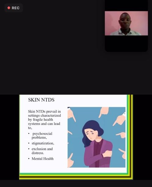 yangaza209's tweet photo. Incredible session with Dr.Rie &amp; @yangaza209  in the @glodermalliance Skin NTDs training hosted by @luisapolo0309 &amp; @TaiAswan.
I appreciate all of you.
@ISNTD_Press your supports is remarkable ✍🙏
 Feel freely to Complete the form below about #NTDs
👇👇
https://t.co/p0bKjrZJcd https://t.co/GK7U12kdk0