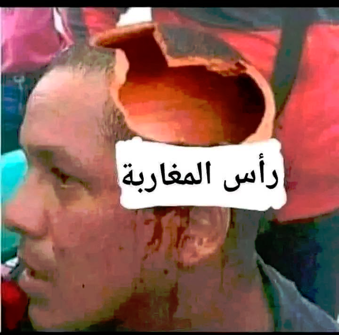 dalidamimi2's tweet photo. @Hassan63674693 @faystyle2022 🐷🇲🇦🐷🇲🇦🐷🤫🤐😂😅🤣🤐🤫🇲🇦🇲🇦 https://t.co/Uj3L035Ufm
