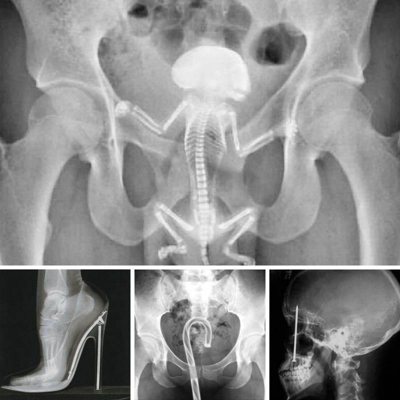 ChaseVisual's tweet photo. Incluso los profesionales médicos se espantaron al ver algunos de estos aterradores rayos X.