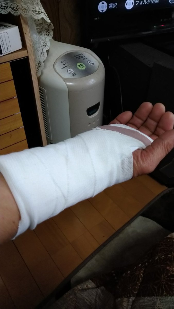 #手首負傷
先週の木曜日に立ち上がろうと左手で棚を持って立とうとした所、左手が滑り後ろに倒れそうになり右手を着いたら右手首に全体重が右手首を痛めてしまい痛みが引かないので病院に行きこうなりました💦
