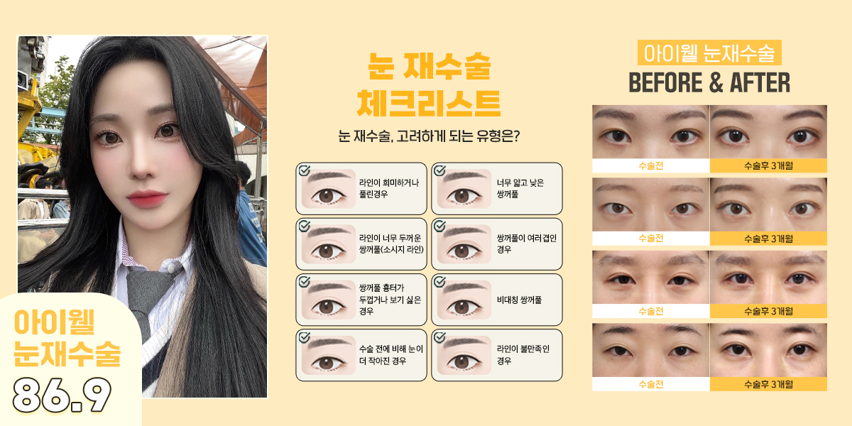iwellps's tweet photo. 💖아이웰 눈재수술💖

눈재수술도! #아이웰성형외과
속상한 마음까지 치유🏥
이번 수술이 진짜 마지막이 되도록!
숙련된 성형외과 전문의의
정확한 문제파악과
환자에게 가장 적합한 수술 진행까지!

📞 상담문의: 02-542-2017
💛 카톡상담: @아이웰성형외과
💌 인스타 DM문의: @iwellps https://t.co/HbLD4SnkAK