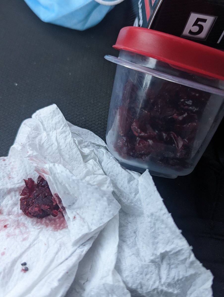 cfan4life1987's tweet photo. Every morning I eat @OceanSprayInc Craisins because I love them. Today however I found what I believe to be a pebble in them which chipped the back of my tooth on the left side of my mouth. Like WTF!? 😡🤬🦷 #oceansprayinc #chippedtooth https://t.co/713VMY6g09