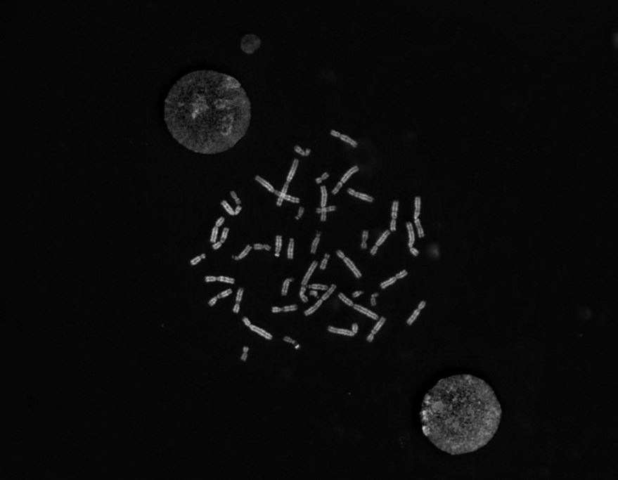 policlinicoMI's tweet photo. Dal Laboratorio di #Genetica Medica di #PoliclinicoMi l’immagine di una cellula del midollo osseo 'immortalata' durante la #metafase, momento della divisione cellulare in cui il DNA è impacchettato nei cromosomi.
La loro analisi permette di individuare possibili anomalie. https://t.co/5djQqkU5oj