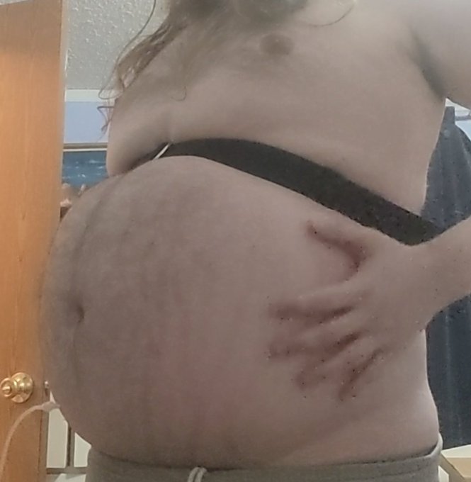 I FIGURED IT OUT. MY NEEDLES HAVE BEEN TOO SMALL.  God I'm an idiot. I used my 18g needle tonight and<a href="/tag/inflation"class="tags"><span>#inflation</span></a>