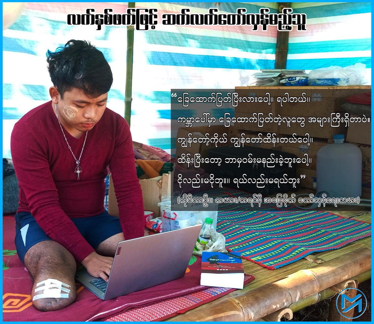 Myanmar_Now's tweet photo. ခြေအစုံဖြတ်ရသော်လည်း လက်နှစ်ဖက်နှင့် ဆက်တော်လှန်မည့် ကရင်နီလူငယ်
https://t.co/y2dIk3scCK
#ဒီးမော့ဆို #ကိုပီတာဦး https://t.co/rQjW1A2d4T
