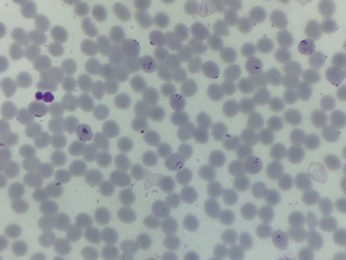 #MorphologyMonday

Parasites on the film. 🦟🩸

Which one?

#OnlyCells #underthescope #parasite