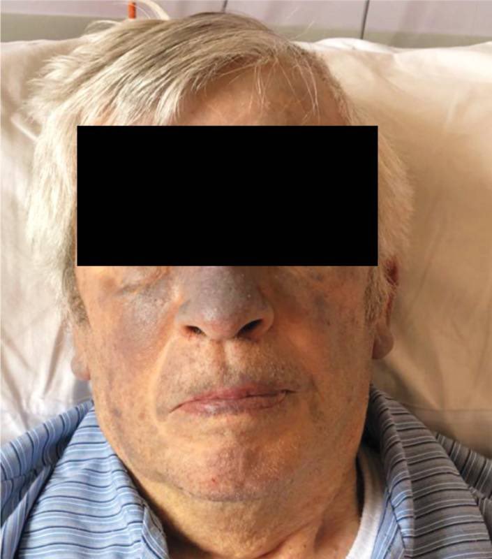 Brown Hospital Medicine On Twitter An 81 year old Man With A History Brown hospital medicine on twitter an 81 year old man with a history
