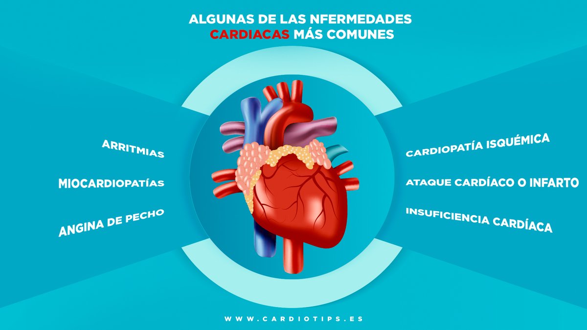 Según la Fundación Española del Corazón hoy día más de 520 millones de personas viven con enfermedades cardiovasculares. Estas son algunas de las más frecuentes👇👇👇
#Cardiotwitter #ECV