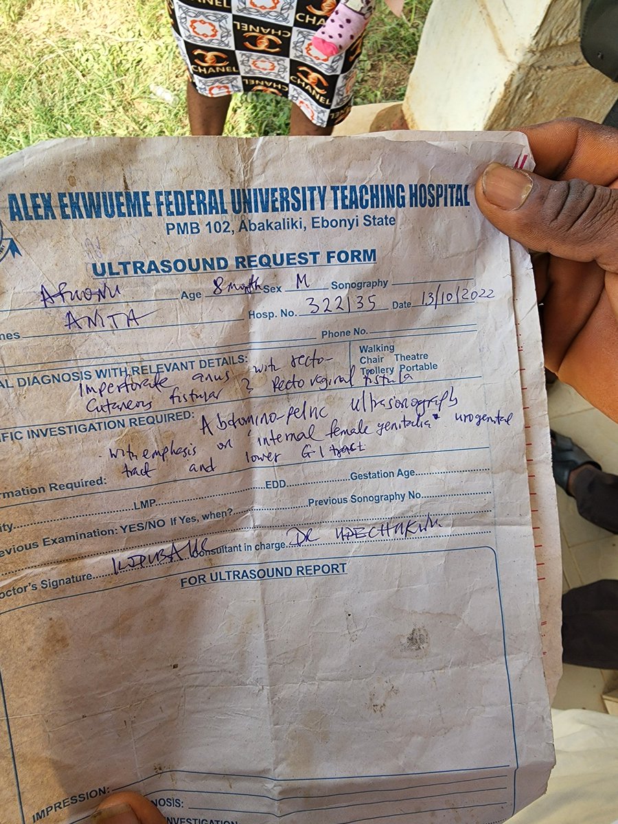 Tunde_OD's tweet photo. All i want for Christmas is for us to help pay for this little girl's surgery so she can live a normal life again. She has a condition where she can only pass stool through the vagina.

The surgery will cost 1.4 million naira
I'll start with 100k donation. Let's do this in 24 hrs https://t.co/4z9BdekTPH
