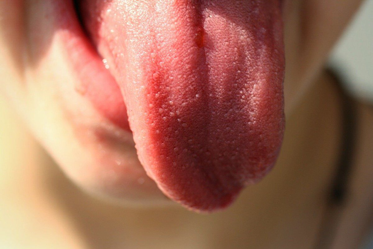 Dry mouth isn’t a disease in and of itself. It’s a medical condition that is caused by a number of things large and small. What should you do about it? #drymouth #oralhealth
dentistwestmichigan.com/dealing-with-d…