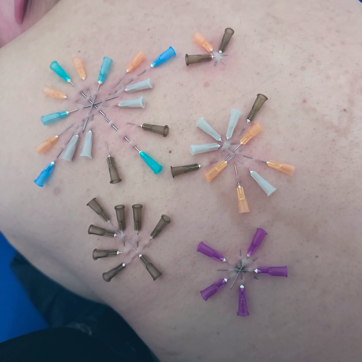 levideepdead's tweet photo. Merry Christmas!
Bottom: @jnnn0w0 

#bdsm #needle #needles #needleplay #hkbdsm https://t.co/E6ctXLR21s