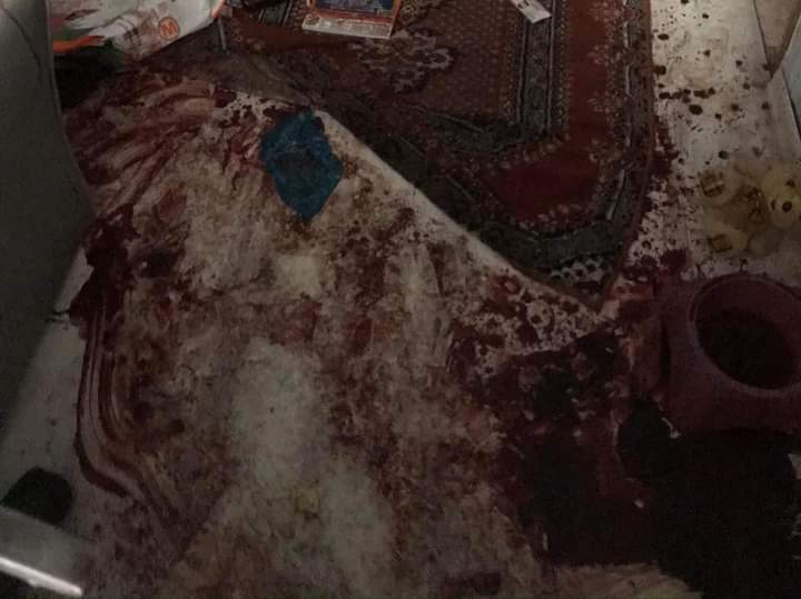 Kızım 1 dakika daha yaşayabilmek için nasıl çabaladı mücadele etti bunu kanıtlamak için bu fotoğrafdan başka ne istiyorsunuz daha neyi savunuyorsunuz  kızım CEYDA YÜKSEL için adalet istiyorum #CeydanınSesiOl #ceydayükseliçinadalet