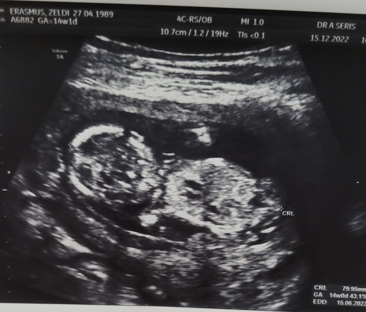 JakarandaPanda's tweet photo. Everyone keeps asking when Caleb will become a big brother. The answer... July 2023 😁 He is very excited and so are we.
We are at 14 weeks, baby is healthy and kicked wildly during the scan. Mommy is doing great, the morning sickness is just about a thing of the past. https://t.co/KuieKKOanY
