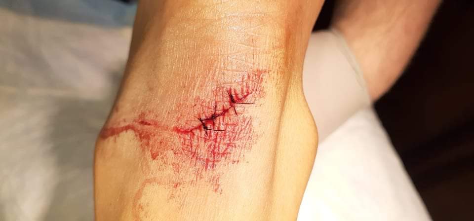 HowardShyona's tweet photo. My mother stabbed Me after using her lighter. She has been abusing we for years. The second time she stole $5600 from her kids when asked about it she attacked.
#BLOWTHISUP https://t.co/cX0bLYUkeY