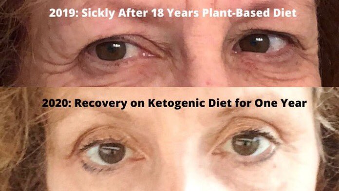 3 years ago, December 2019, I joined Twitter anonymously as "Recovering Vegan" so I could follow the #Keto community without offending my #vegan friends and family. 

I had hit "rock bottom" -- in much pain, could barely walk, all I could do was tweet from the couch.